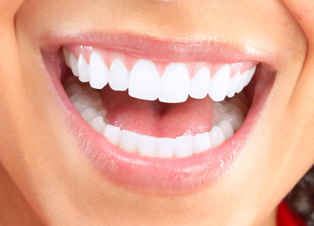 What are Veneers?… Cosmetic Dentistry Options to Choose From.